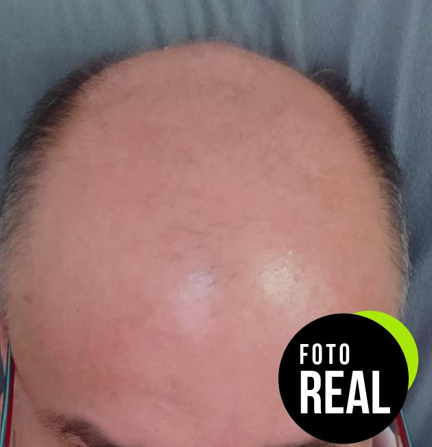 isdin-champu-anticaida-uso-diario-foto-1