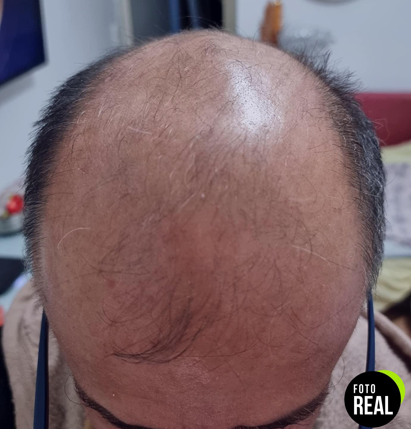 isdin-champu-anticaida-uso-diario-foto-2