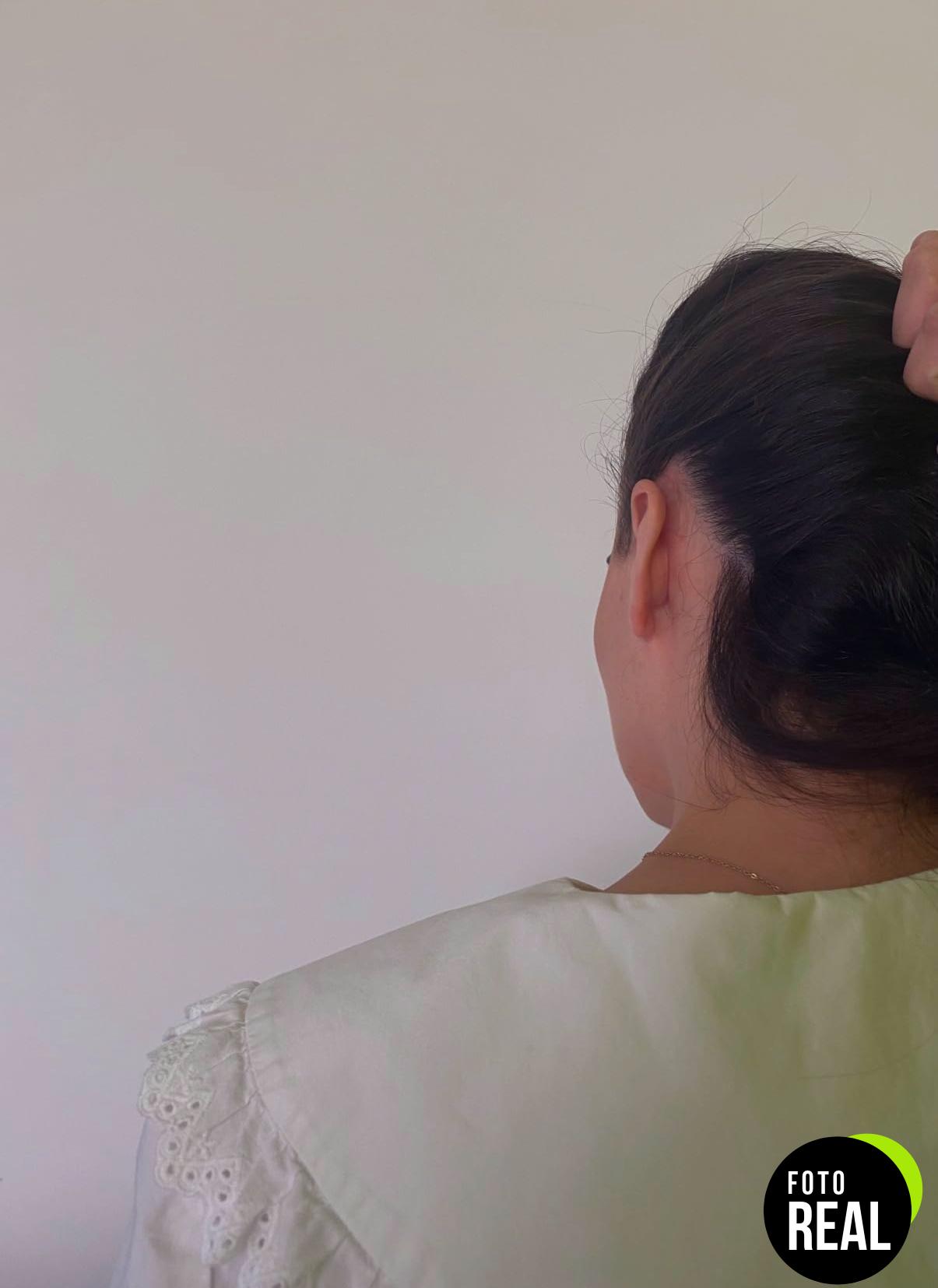 otostick-corrector-orejas-8-foto-1