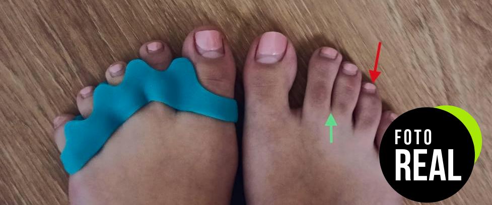 separadores-dedos-pies-corrector-2-pares-foto-1